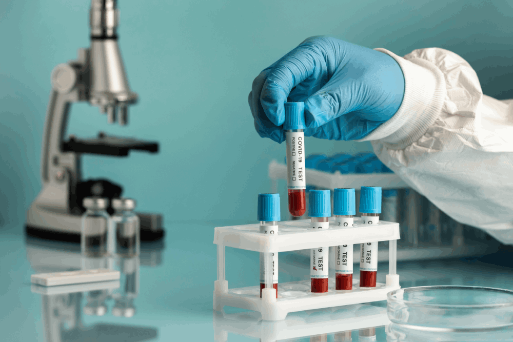 Blood sample testing in pathology laboratory at Sri Chakra Hospital Chennai